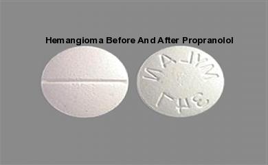 propranolol 20 Propranolol 20