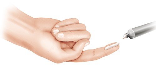 Ivermectin Kosten