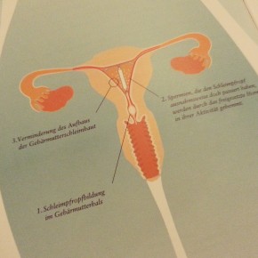 Misoprostol Tabletten Spirale Misoprostol Tabletten Spirale