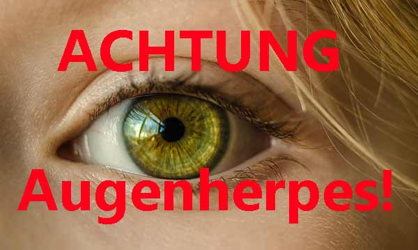 herpes auge aciclovir tabletten