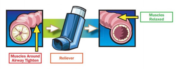 Salbutamol ct kaufen