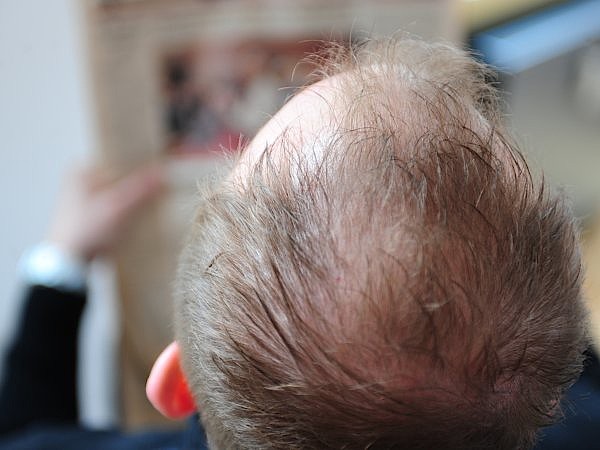 finasterid generische bestellen
