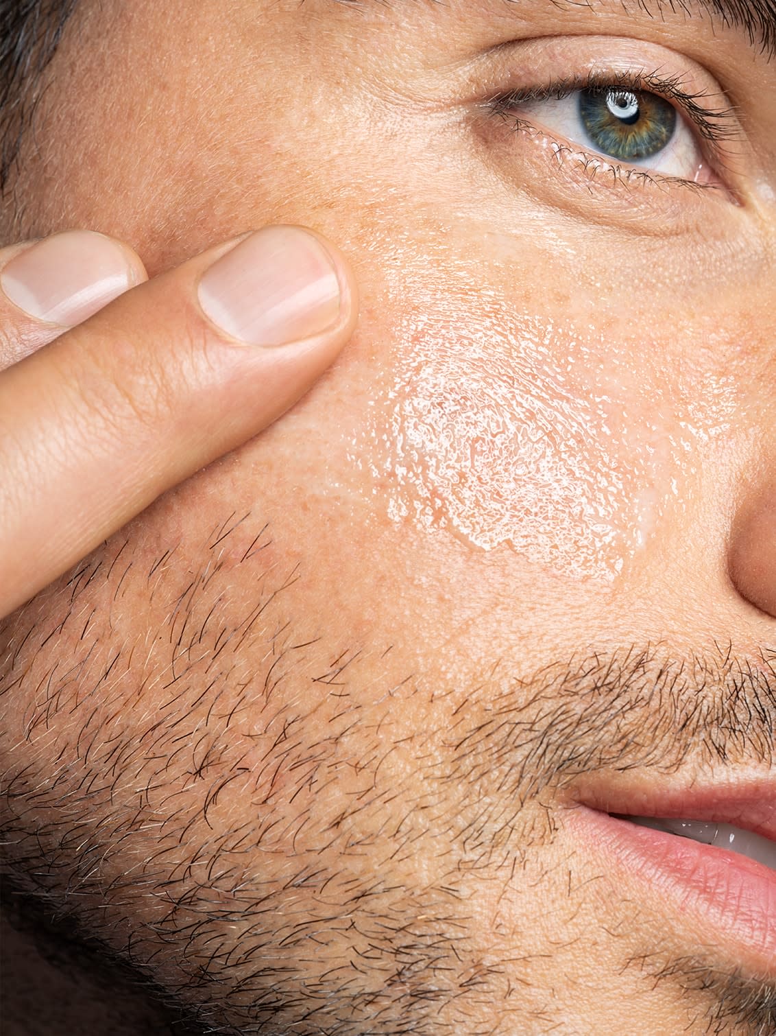 Roaccutane Am Billigsten Roaccutane Am Billigsten