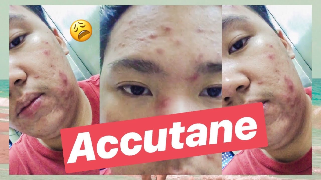 accutane generika accutane generika