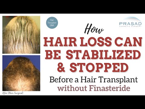 billig finasteride