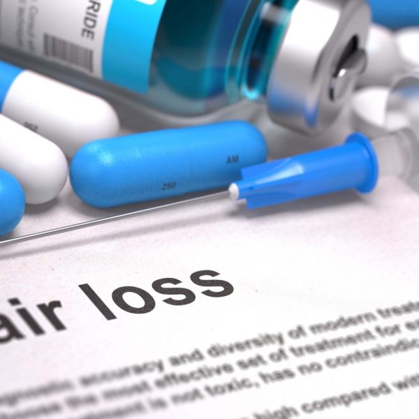 Finasteride and minoxidil online
