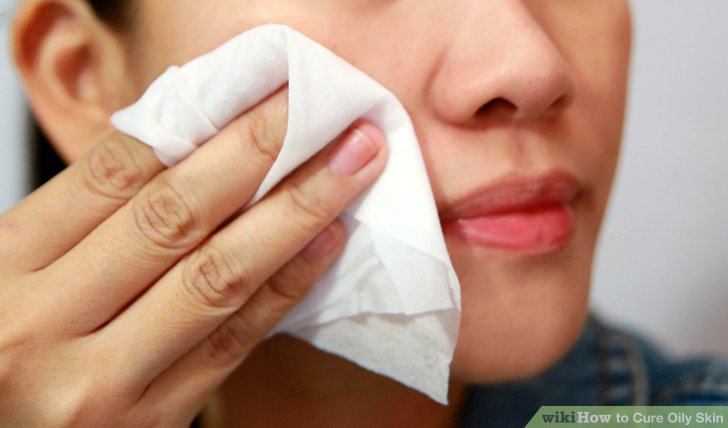 Billig roaccutane Billig roaccutane