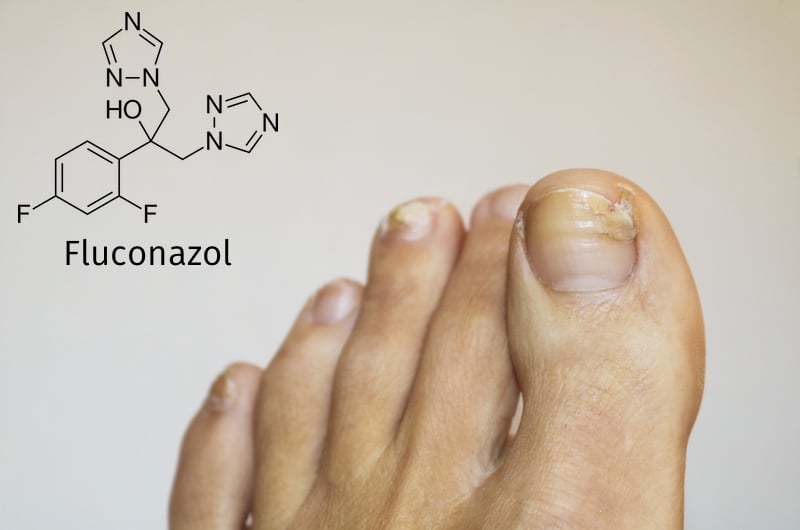 kann man fluconazol ohne rezept kaufen kann man fluconazol ohne rezept kaufen