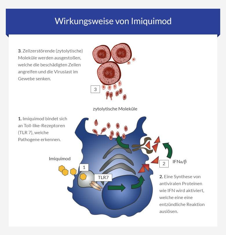 imiquimod kaufen ohne rezept