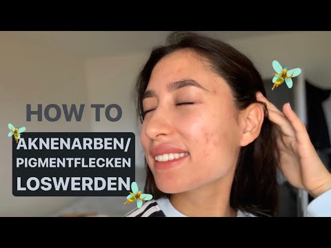 Wie man aknenormin kauft Wie Man Aknenormin Kauft