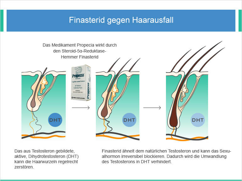 Finasterid Heumann 5 Mg Preis