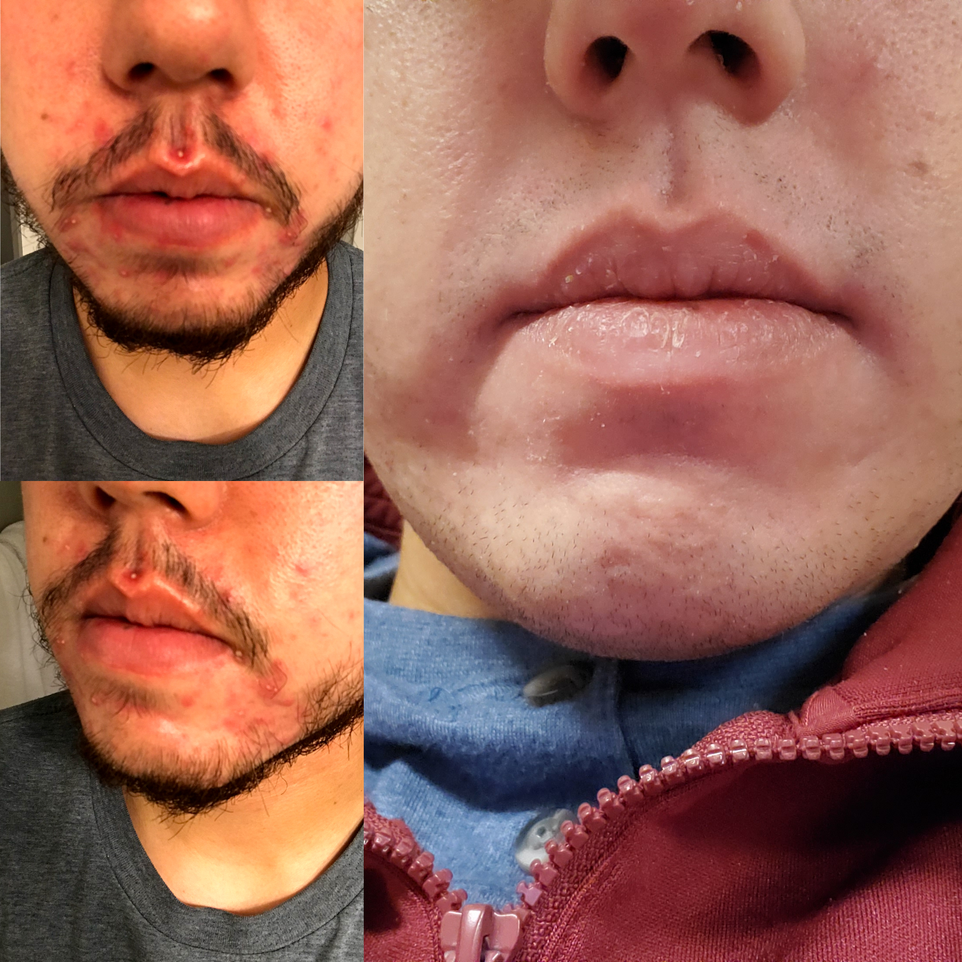 Ivermectin apotheke online kaufen