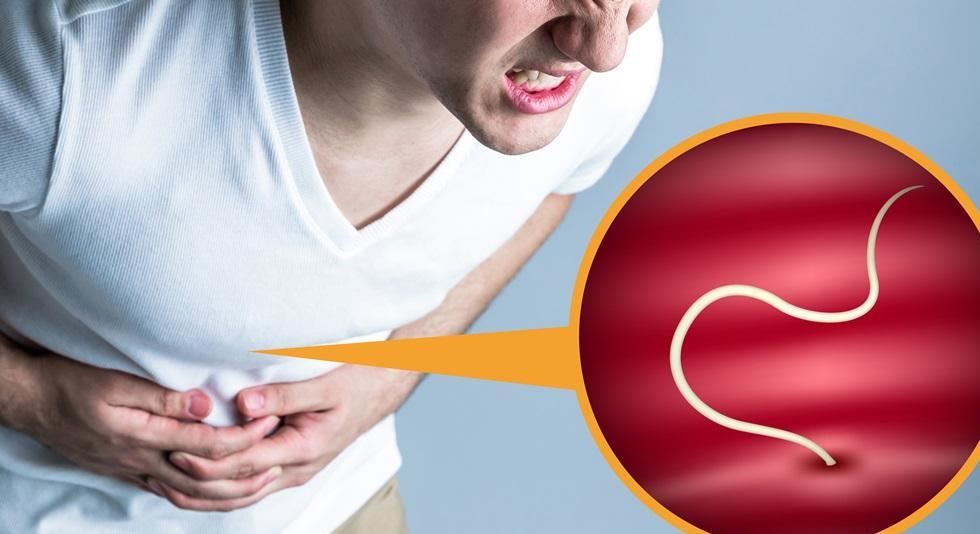 Ivermectin Tabletten Kaufen Rezeptfrei