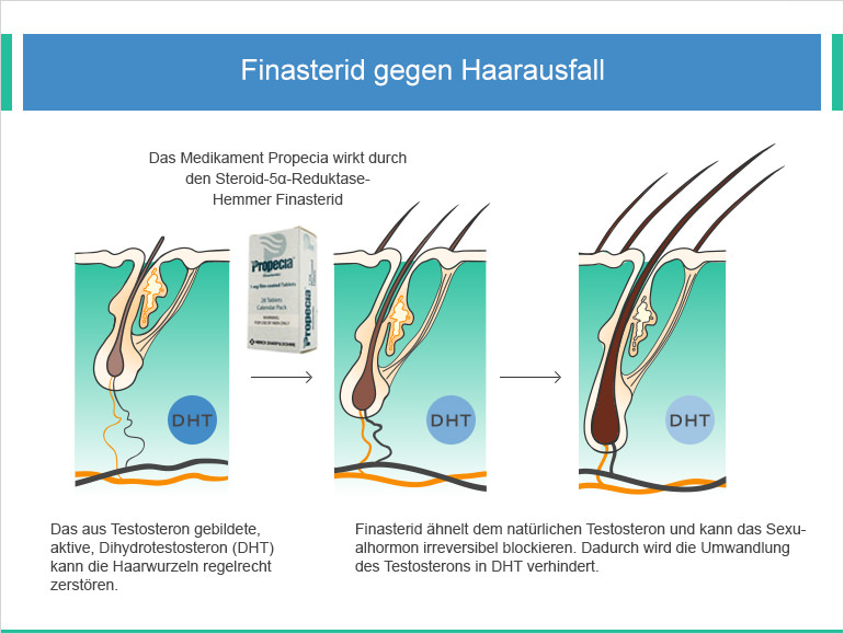 Online apotheke finasterid