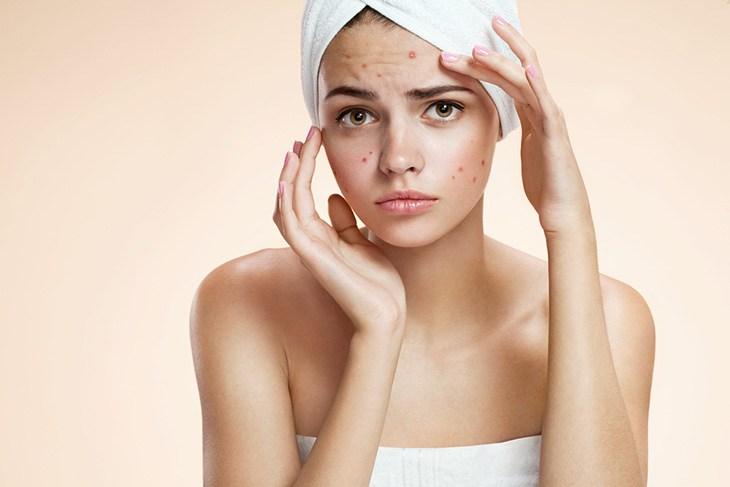 roaccutane online bestellen zonder recept roaccutane online bestellen zonder recept